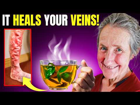 Heal Varicose Veins with This Proven Natural Solution! | Barbara O’Neill