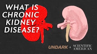 What is Chronic Kidney Disease and how does dialysis work?