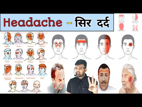 Headache | सिर दर्द | Medicine | Treatment | Injection | Tablet | Pharmacy | Nursing | Doctor | दवाई