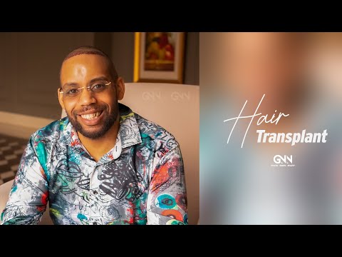 Watch this : From Bald to Bold - Donavan's Hair Transplant Journey