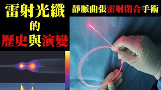 雷射光纖的歷史與演變，靜脈曲張雷射閉合手術｜許原彰醫師：台中，高雄，台南，台北，新竹，靜脈曲張專家