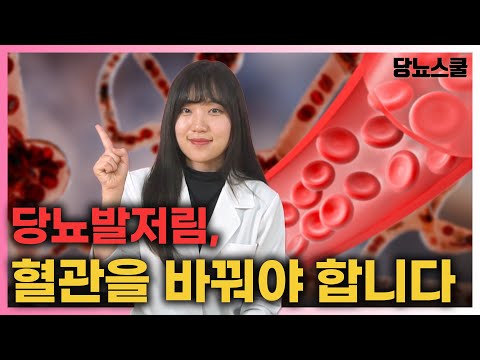 혈관건강이 개선되면, 당뇨발저림도 개선됩니다! | 당뇨문의 : 1644-5178