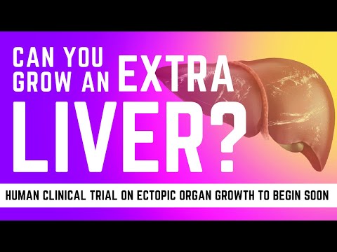 Can you grow extra livers? Using cell therapies this may become common