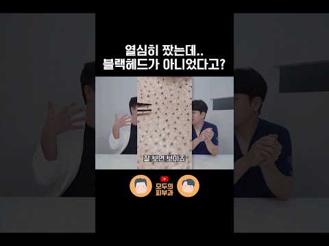 블랙헤드인 줄 알고 짰던 게 '이것'이었을 수도 있습니다