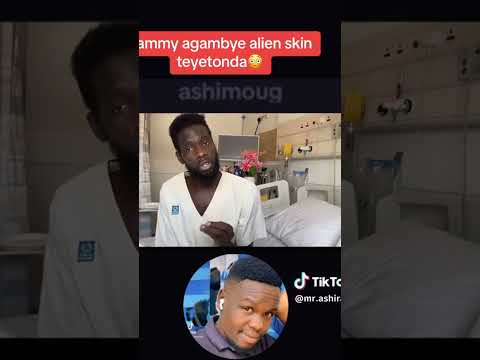 #Sammy Da Might family# aganye #Alien skin# okwetonda,watch full video