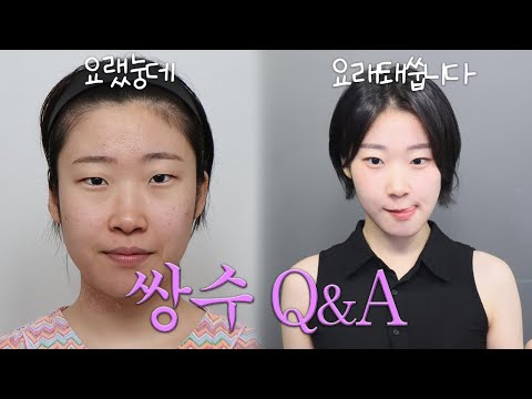 쌍수 Q&A