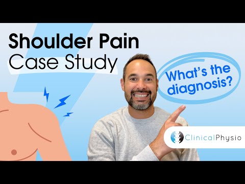 Shoulder Pain Case Study | Expert Physio Review taking you through Assessment and Diagnosis!