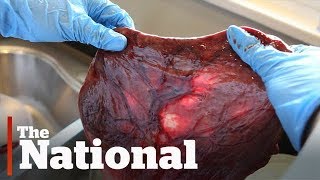 Don't eat placenta, medical experts say