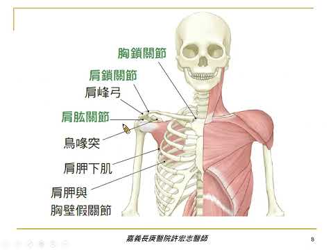 透視肩痛