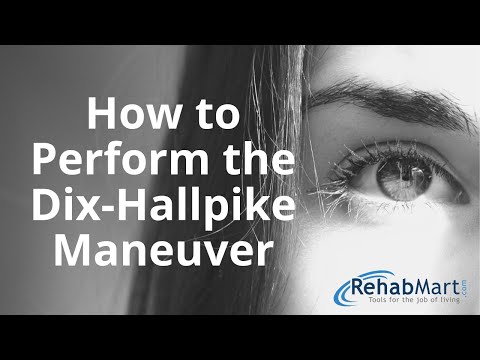 How to Perform the Dix-Hallpike Maneuver for Vertigo