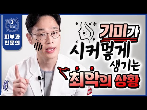 레이저토닝 백번 받아도 기미가 절대 좋아지지 않는 이유 | 기미 치료하고 싶으면 "이것"부터 확인하세요!