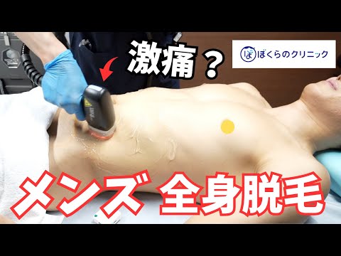 【メンズ脱毛】ヤグレーザーで全身脱毛したらとんでもないことになった・・・【都度払い】