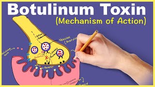 Botulinum Toxin: Mechanism of Action