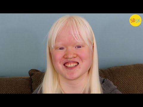 An Autistic Teen with Albinism (An Adoption Story)