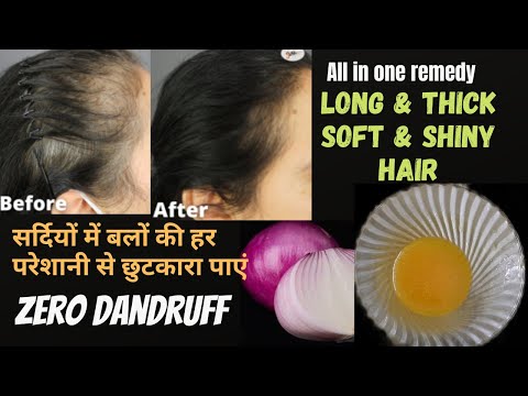 15 days winter hair growth challenge, zero dandruff stop hairfall regrow lost hair, get 2X density