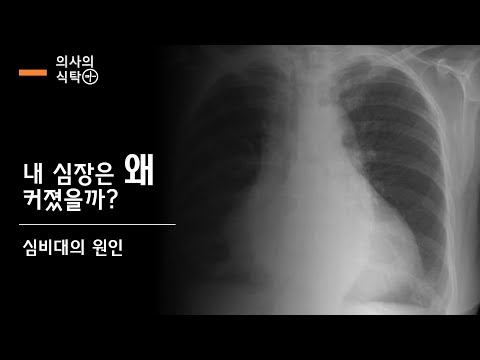 심비대 (3) : 내 심장은 왜 커졌을까? 심비대 원인