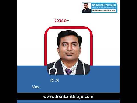 Case Study Aortic Dissection | Dr.Srikanth Raju | Vascular Surgeon | Hyderabad