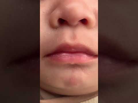 child's lips #subscribe #share #viral #shortsyoutube #thailand #baby #lips