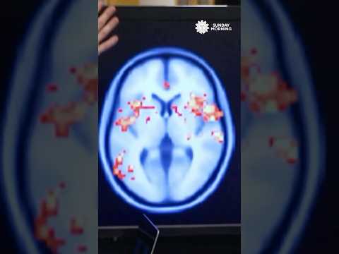 Expert explains the effects of ASMR on a person's brain #shorts