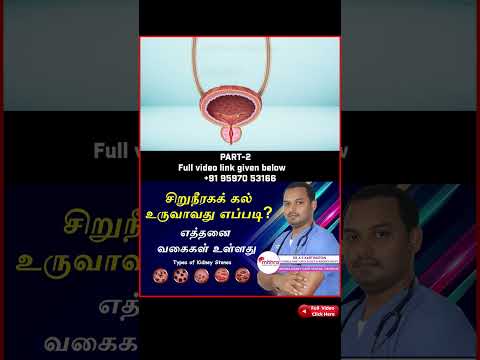 Part- II KIDNEY STONE FORMATION AND STONE TYPES-சிறுநீரகக் கல் உருவாவது எப்படி? எத்தனை வகைகள் உள்ளது