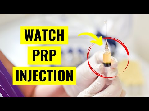 Watch a PRP Injection for Knee Arthritis Pain! (Ultrasound Guidance)