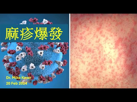 麻疹爆發 - Measles 2024 by Dr. Mike Kwan