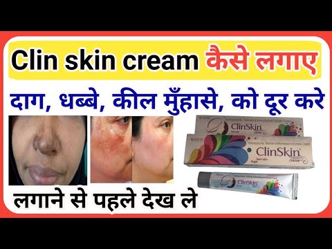 Clin skin cream कैसे लगाए लगाने से पहले यह वीडियो देख लेl how to apply Clin skin cream. #cngajbhiye