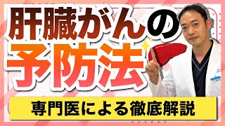 肝臓がんの予防法について　専門医が徹底解説