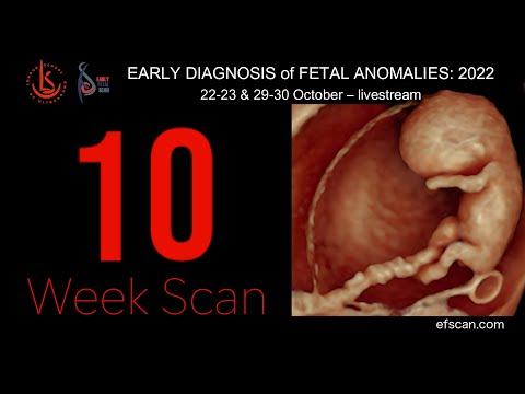 10 Week Scan - EARLY DIAGNOSIS of FETAL ANOMALIES 2022