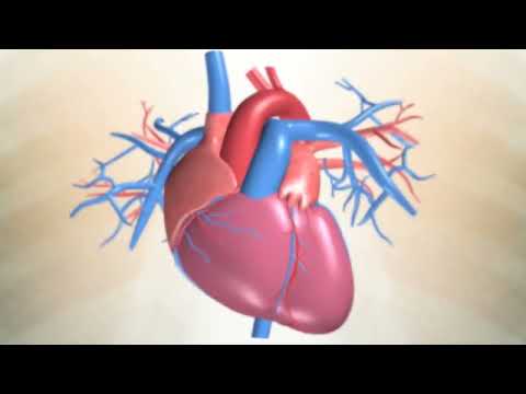 What causes a heart attack? | Heart Foundation NZ