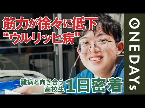 【患者会の代表】ウルリッヒ病の高校生に1日密着してみた