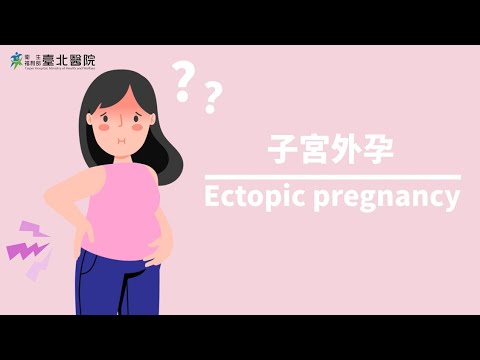 【臺北醫院】認識子宮外孕 Ectopic pregnancy