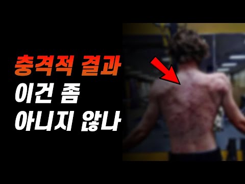 스테로이드 사용의 충격적 결과와 부작용, 사용하면 안되는 이유