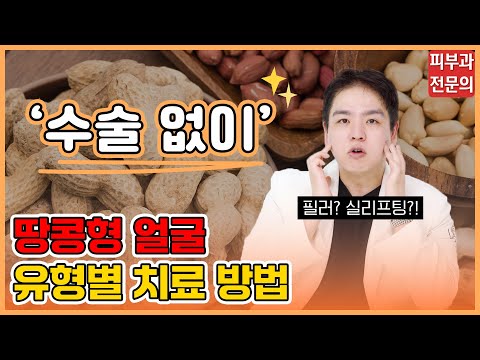 땅콩형 얼굴 시술, 뭘 해야 할까?｜피부과 전문의가 유형별 치료법을 알려드립니다