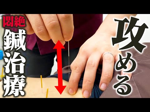 【肩こり 鍼】肩こりでお悩みの体に鍼治療！ギリギリを攻めた治療でサカヒロ先生悶絶！！@sakahirosensei