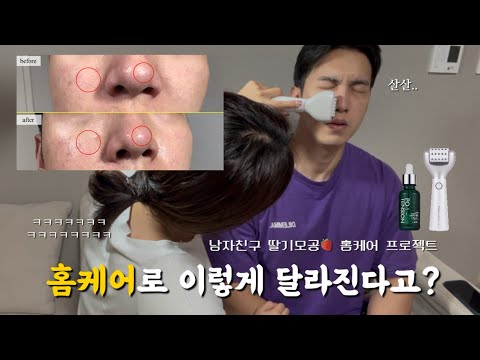 피부과X 남친 딸기모공도 줄이는🍓VIP 커플 홈케어의 날 | 집에서 하는 포텐자 | 셀로라바이 펜타샷 모공리무버 모공세럼