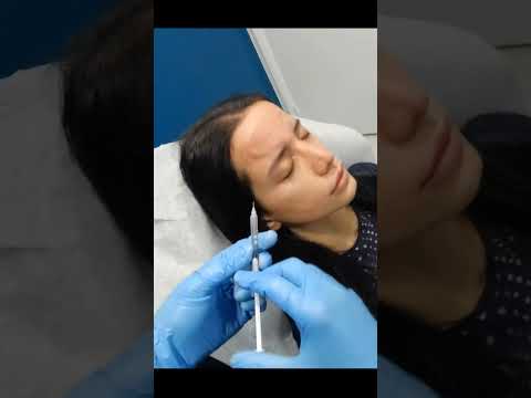 Best Frown Lines & Crow's Feet Botox Treatment in Plantation Med Spa, Florida #shorts