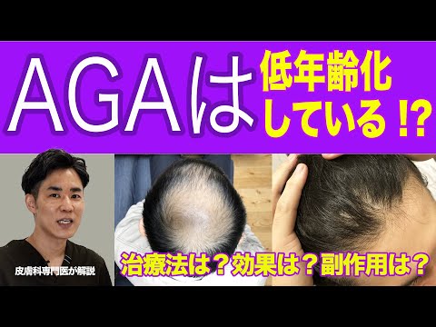 男性型脱毛症AGAは低年齢化している！？