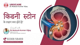 KIDNEY STONE SYMPTOMS | किडनी स्टोन के क्या लक्षण होते हैं kidney stone symptoms in men / women