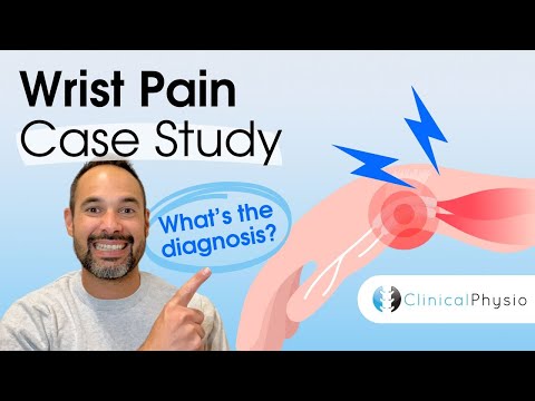 Wrist Pain Case Study | Expert Physio Review taking you through Assessment and Diagnosis!