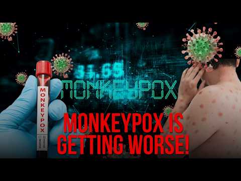 Health Officials Confirm the Monkeypox Outbreak Just Got WAY WORSE