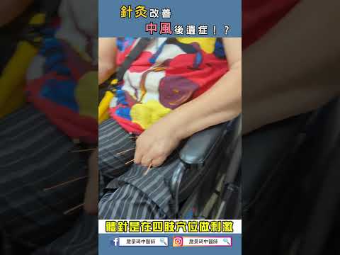 針灸改善中風後遺症！？# 詹景琦中醫師 # 詹景琦 #太一 #太一中醫 #中醫 #shorts #中風