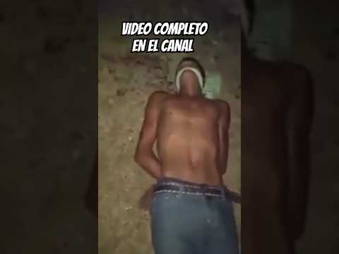 "QUACK" Contexto Del Vídeo #crime #casosdelavidareal #casosbizarros #truecrimecommunity #miedo