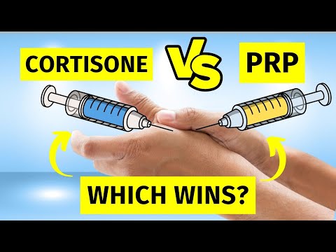 What Science ACTUALLY Says About Thumb Arthritis - Cortisone vs PRP Injection