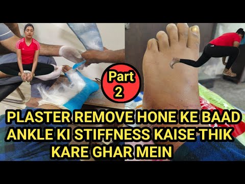 Plaster Remove Karane Ke Baad Ankle Ki Stiffness kaise Thik Kare Ghar Mein #fracture #ankleinjury