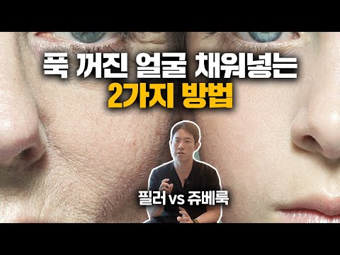 내 얼굴을 채워주는 "필러 VS 쥬베룩 볼륨" 장단점을 알려드립니다