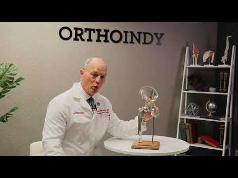 Dr. Monesmith Explains: How Does a Hip Replacement Work?