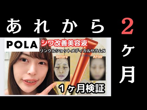 【シワ改善続報！】POLAさん、ごめんなさい。【スゴかった】