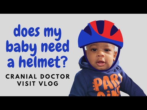 Does My Baby Need a Helmet to Fix Flat Head| Plagiocephaly Treatment | Cranial Technologies Visit