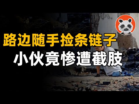 無可輓回 四肢只剩右手！中國首例核輻射受害者宋學文，真實而悲慘的人生……【🐼熊貓周周】